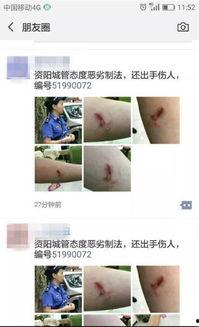 女子爆料城管打人视频,视频揭露惊人一幕
