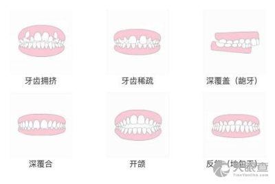 齐美口腔爆料视频大全,揭秘口腔护理那些事  第2张