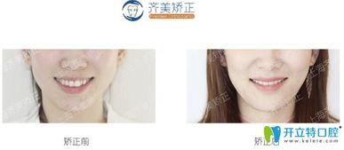 齐美口腔爆料视频大全,揭秘口腔护理那些事  第3张