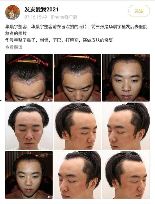 整容爆料大全视频下载免费,整容爆料大全视频免费下载 第3张 整容爆料大全视频下载免费,整容爆料大全视频免费下载 第3张